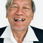 台中全口重建