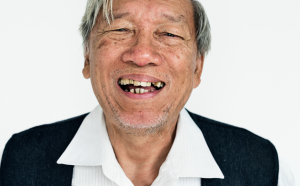 台中全口重建